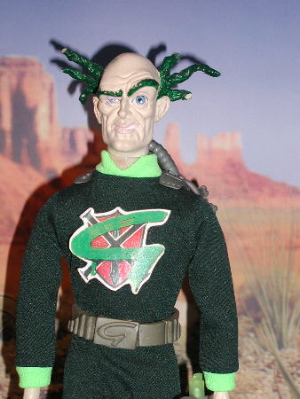 Prof.Gangrene